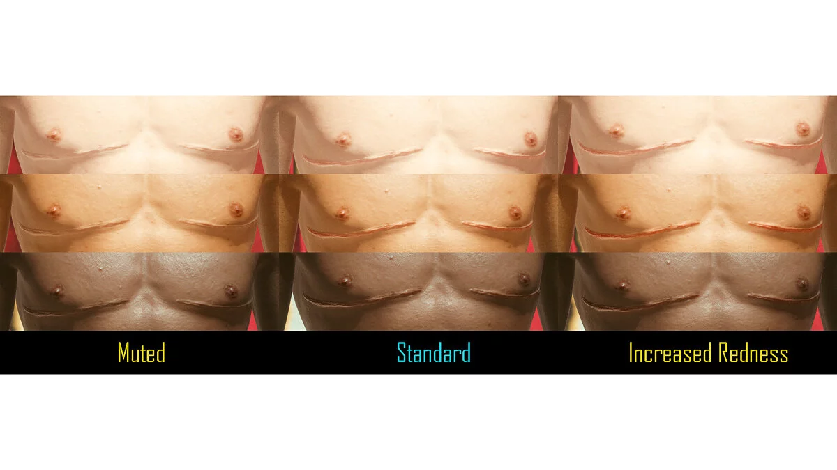 Cyberpunk 2077 — Хирургические шрамы на груди