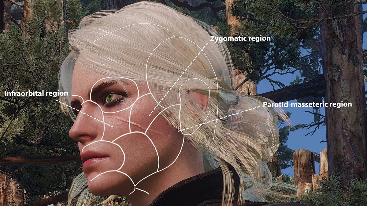 The Witcher 3: Wild Hunt - Complete Edition — Правильный шрам Цири