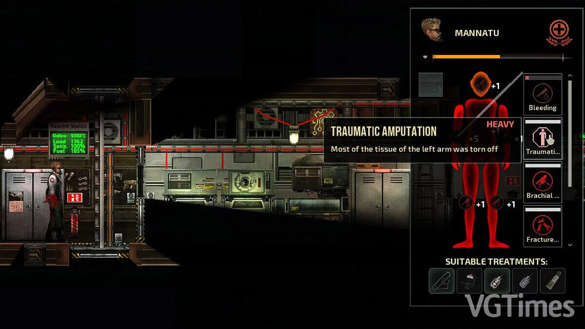 Barotrauma — Neurotrauma