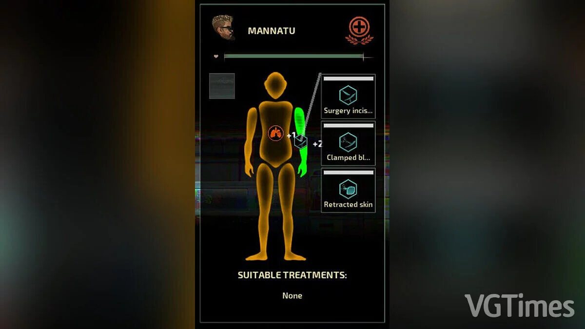 Barotrauma — Neurotrauma