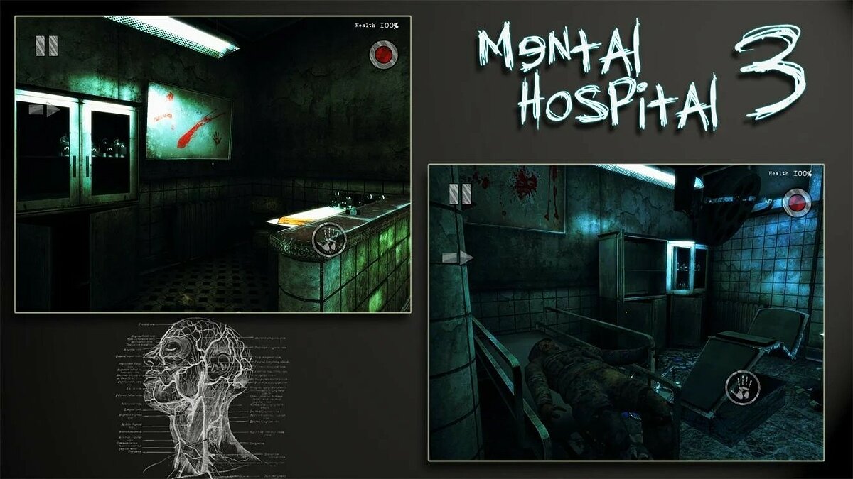 Mental Hospital 3 - что это за игра, трейлер, системные требования, отзывы  и оценки, цены и скидки, гайды и прохождение, похожие игры