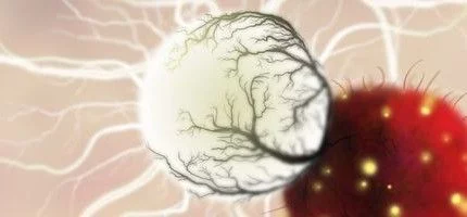 Botanicula: уже в продаже