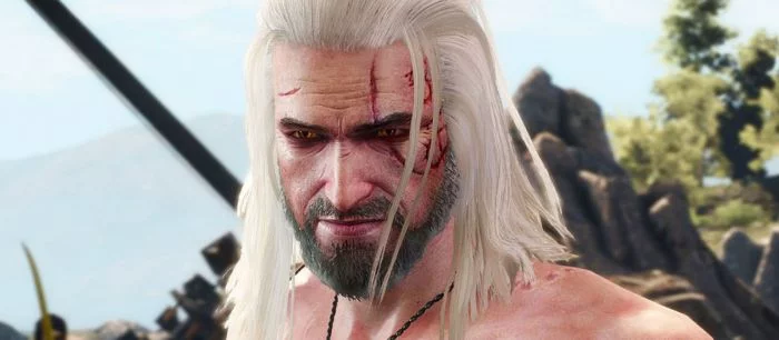 Актер, играющий Геральта в «Ведьмаке» от Netflix, показал свои шрамы — фото