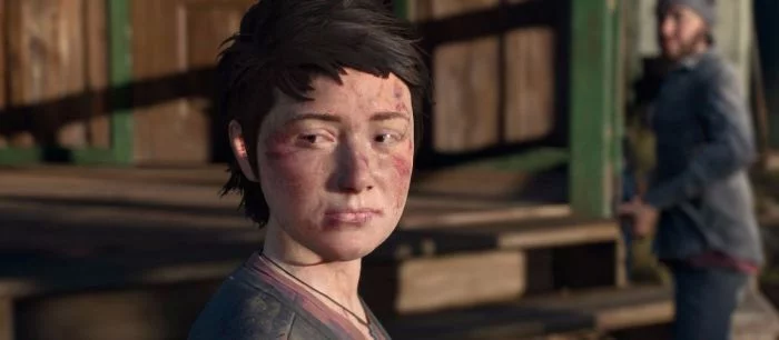 Как помочь выжившим в Days Gone