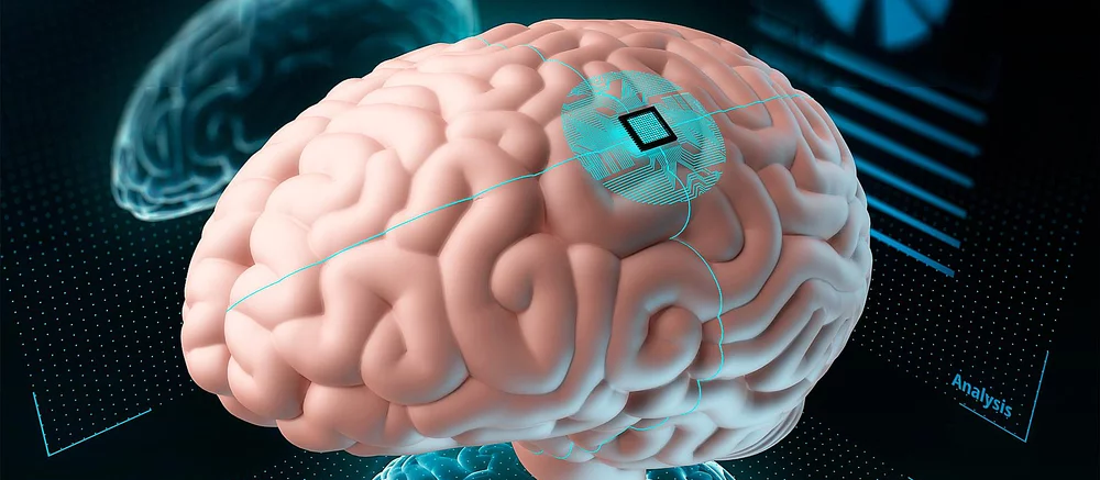 Neuralink ищет еще кандидатов на вживление чипов в мозг