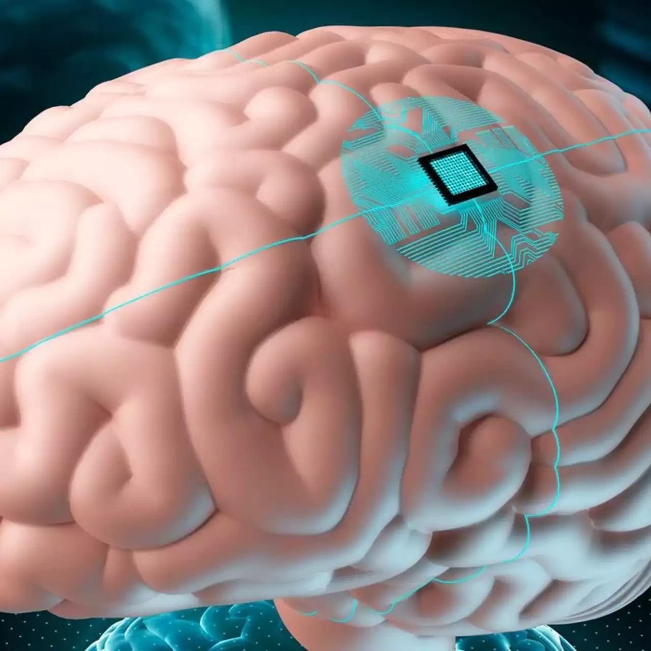 Neuralink ищет еще кандидатов на вживление чипов в мозг Neuralink ищет еще кандидатов на вживление чипов в мозг