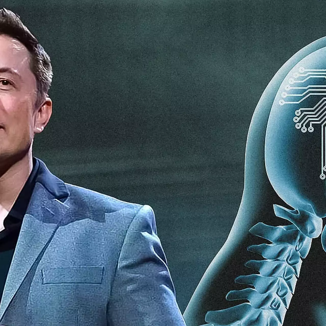 Маск сообщил о вживлении третьего импланта Neuralink в мозг человека Маск сообщил о вживлении третьего импланта Neuralink в мозг человека