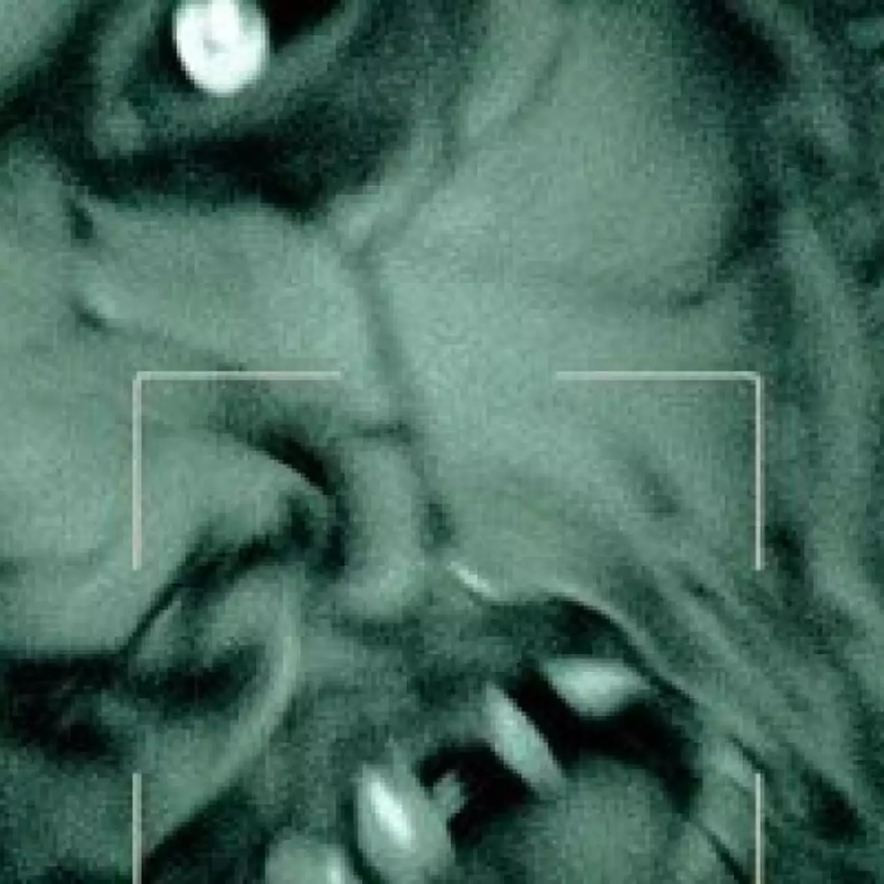 Новый трейлер Outlast может напугать вас